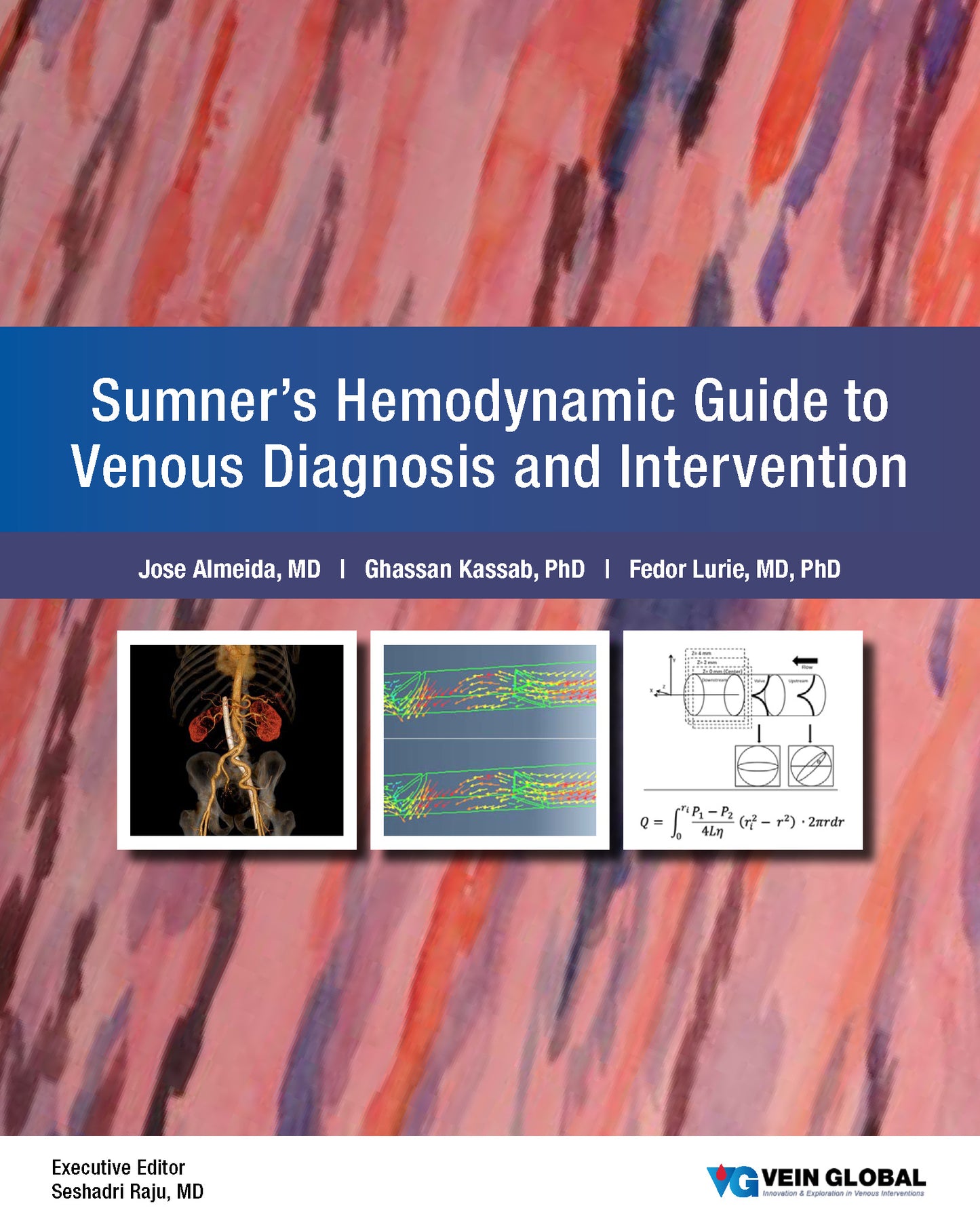 Sumner's Hemodynamic Guide to Venous Diagnosis and Intervention